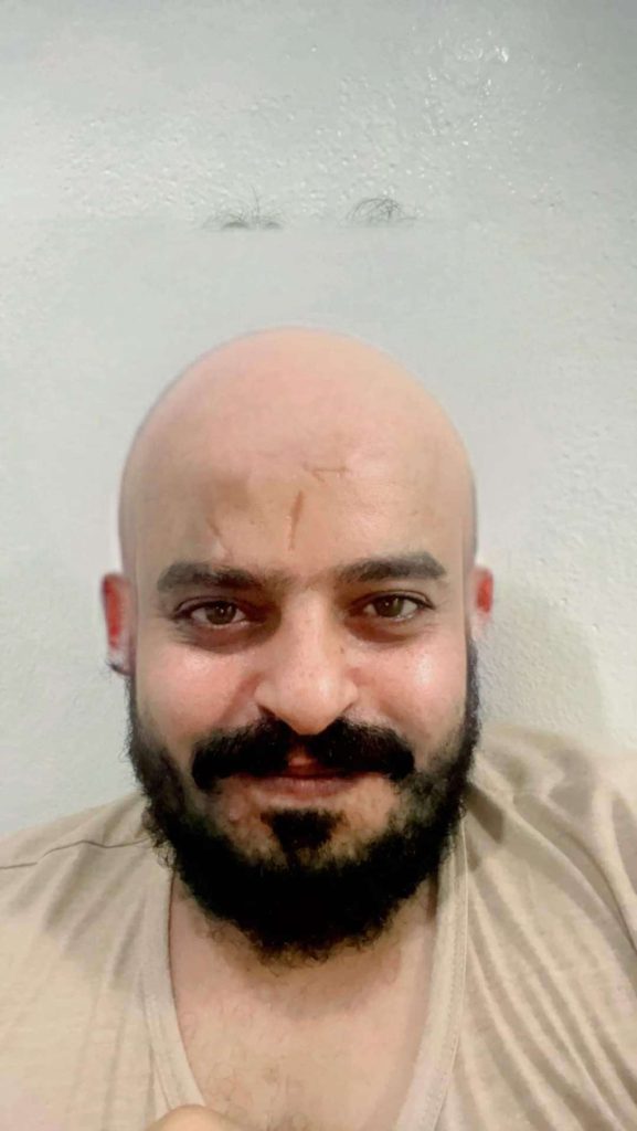 شاب يمني يحلق شعر رأسه صفر بالموس بسبب  خسارة النصر السعودي ” الاسم والصورة “